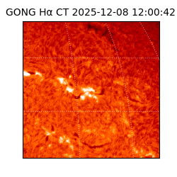 gong - 2025-12-08T12:00:42
