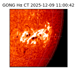 gong - 2025-12-09T11:00:42
