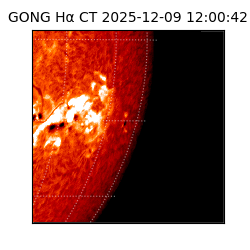 gong - 2025-12-09T12:00:42