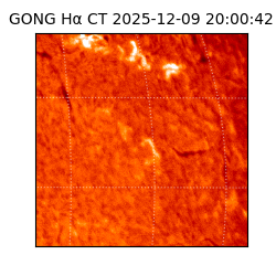 gong - 2025-12-09T20:00:42