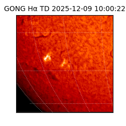 gong - 2025-12-09T10:00:22