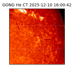 gong - 2025-12-10T16:00:42