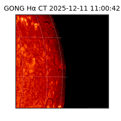 gong - 2025-12-11T11:00:42