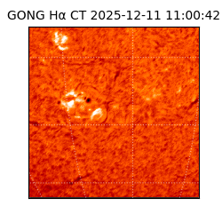 gong - 2025-12-11T11:00:42