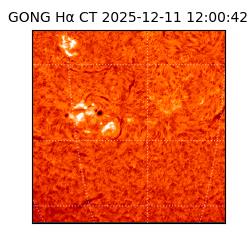 gong - 2025-12-11T12:00:42