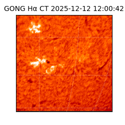 gong - 2025-12-12T12:00:42