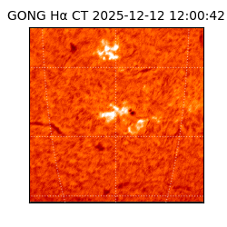 gong - 2025-12-12T12:00:42