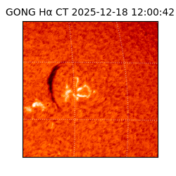 gong - 2025-12-18T12:00:42