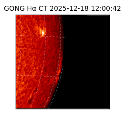 gong - 2025-12-18T12:00:42