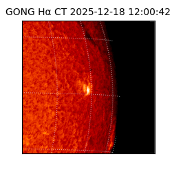 gong - 2025-12-18T12:00:42