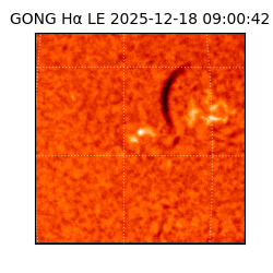 gong - 2025-12-18T09:00:42