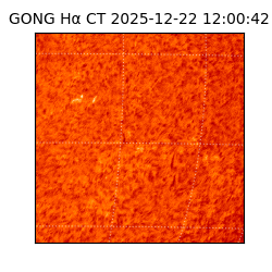gong - 2025-12-22T12:00:42