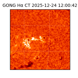 gong - 2025-12-24T12:00:42