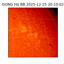 gong - 2025-12-25T20:10:02