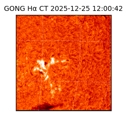 gong - 2025-12-25T12:00:42