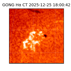 gong - 2025-12-25T18:00:42