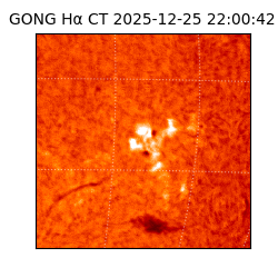 gong - 2025-12-25T22:00:42