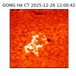 gong - 2025-12-26T12:00:42