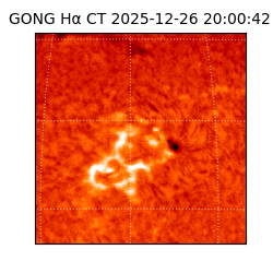 gong - 2025-12-26T20:00:42
