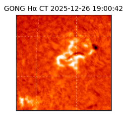 gong - 2025-12-26T19:00:42