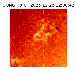 gong - 2025-12-26T22:00:42