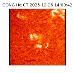 gong - 2025-12-26T14:00:42