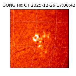 gong - 2025-12-26T17:00:42