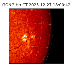 gong - 2025-12-27T18:00:42