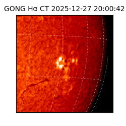 gong - 2025-12-27T20:00:42