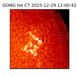 gong - 2025-12-29T12:00:42