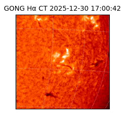 gong - 2025-12-30T17:00:42