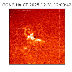 gong - 2025-12-31T12:00:42