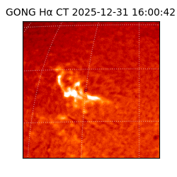 gong - 2025-12-31T16:00:42