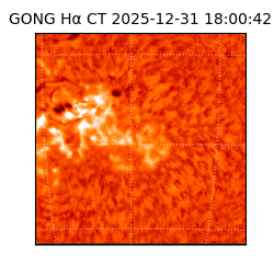 gong - 2025-12-31T18:00:42