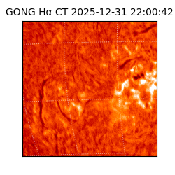 gong - 2025-12-31T22:00:42