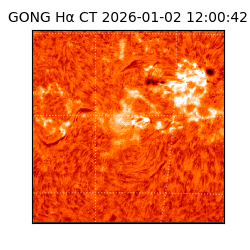 gong - 2026-01-02T12:00:42