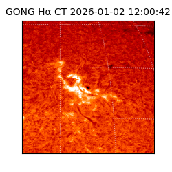 gong - 2026-01-02T12:00:42