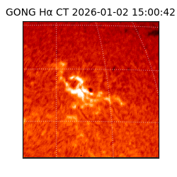gong - 2026-01-02T15:00:42