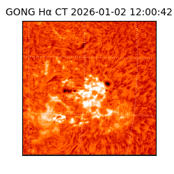 gong - 2026-01-02T12:00:42