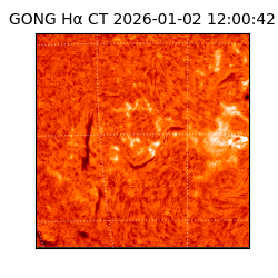 gong - 2026-01-02T12:00:42
