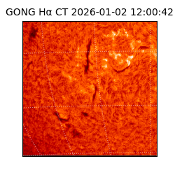 gong - 2026-01-02T12:00:42
