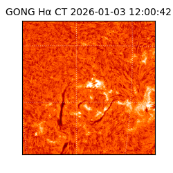 gong - 2026-01-03T12:00:42
