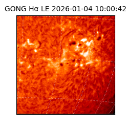 gong - 2026-01-04T10:00:42