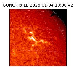 gong - 2026-01-04T10:00:42
