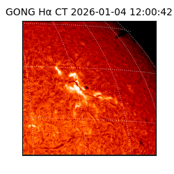 gong - 2026-01-04T12:00:42