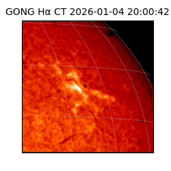 gong - 2026-01-04T20:00:42
