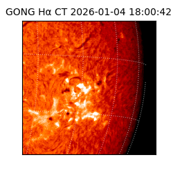 gong - 2026-01-04T18:00:42
