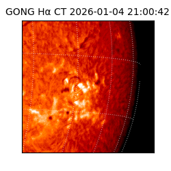 gong - 2026-01-04T21:00:42