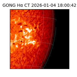 gong - 2026-01-04T18:00:42
