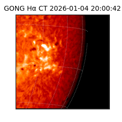 gong - 2026-01-04T20:00:42